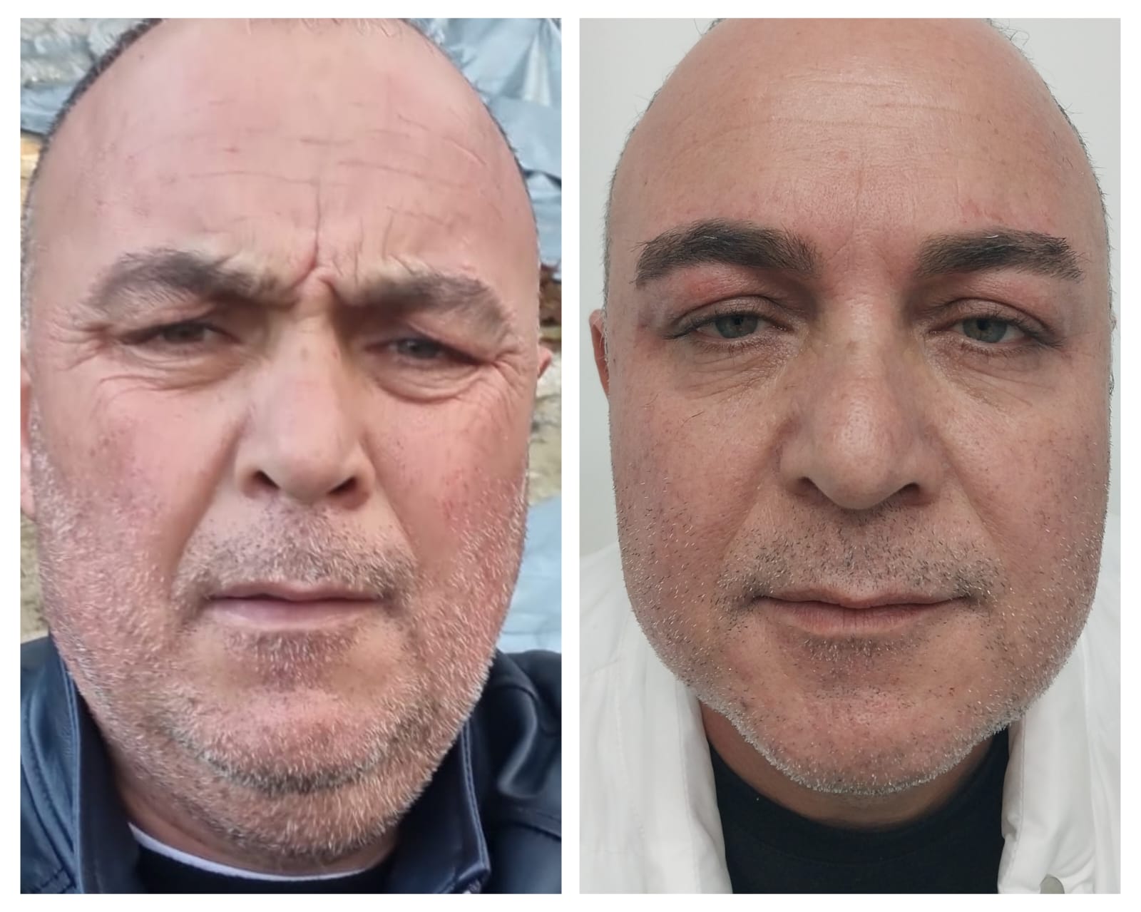Göz ve Yüz